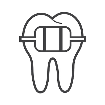 Orthodontic Alignment